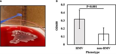 Biofilm Production by Carbapenem-Resistant Klebsiella pneumoniae Significantly Increases the Risk of Death in Oncological Patients